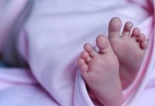 Bebê nasce sem rosto e parte do crânio e gera escândalo por negligência médica; entenda