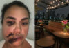 Mulher agredida em restaurante no Jockey faz cirurgia de emergência