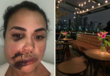 Mulher agredida em restaurante no Jockey faz cirurgia de emergência