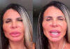 Gretchen mostra resultado de procedimento estético: “Tudo novo”