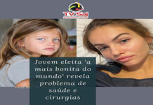 Jovem eleita ‘a mais bonita do mundo’ revela problema de saúde e cirurgias