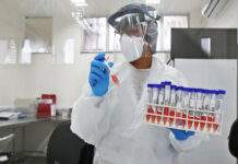 Com uma morte por Covid nas últimas 24h, Salvador registra 53 novos casos da doença