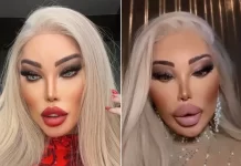 Jessica Alves faz novo preenchimento nos lábios e resultado impressiona; compare