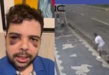 Gustavo Mendes se defende sobre ter simulado agressão e publica vídeo do momento da pedrada